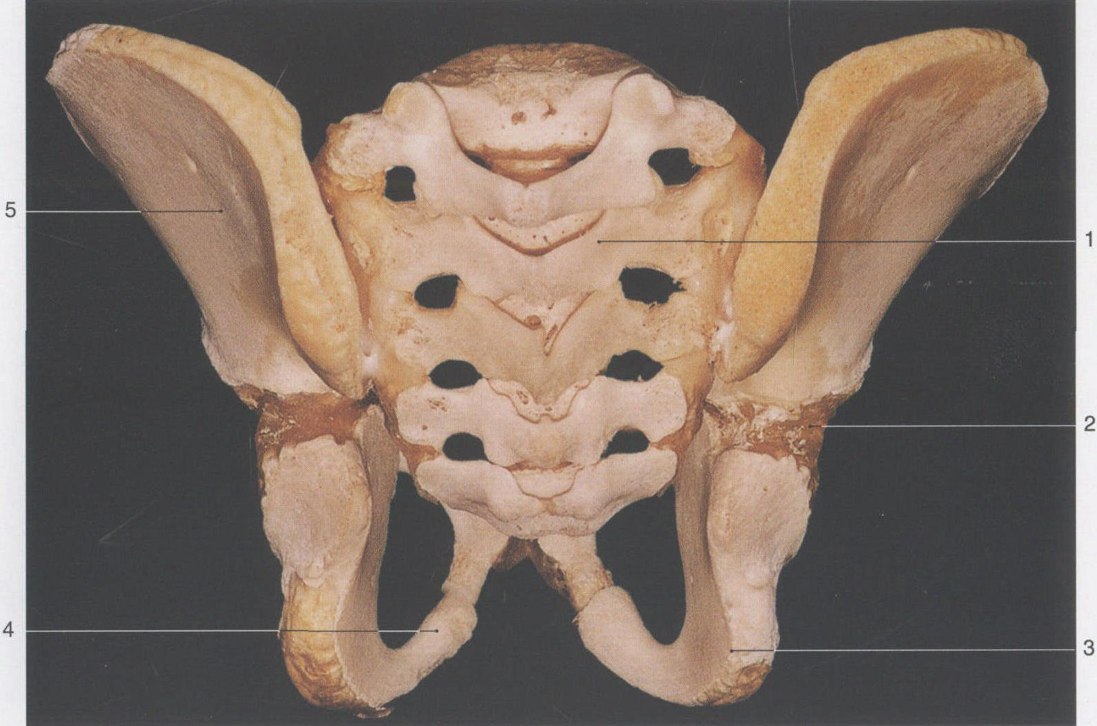 11. 新生兒骨盆(后面觀)